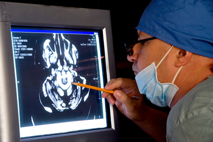 Врач смотрит снимок головного мозга, пораженный альцгеймером 