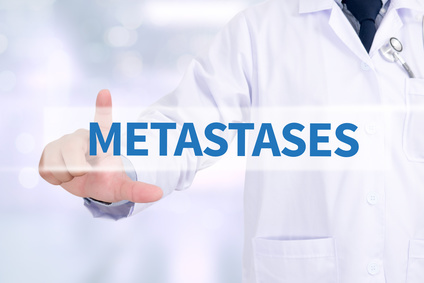метастазы