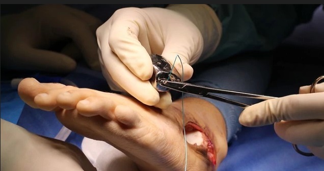 Израильский врач пришивает ребенку ногу из искусственного имплантата